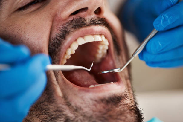 Best Emergency Dentist for Knocked-Out Tooth in Hollywood, SC